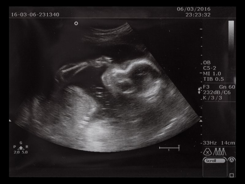 Przewodnik po badaniach prenatalnych – etapy i procesy krok po kroku